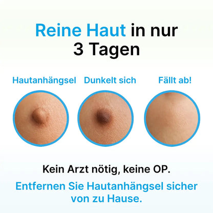 FleckWeg™ Entferner-Set